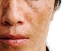 Hautprobleme verstehen und behandeln: Tipps für gesunde Haut
